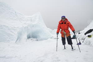 Climbing Mount Everest while using prosthetic sockets developed in Upper Bavaria